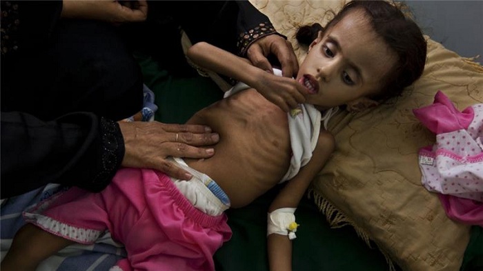 Yemen war: `My children are starving to death`